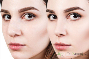 در چه نقاطی از صورت و بدن برای رفع نقایص می توان از جراحی زیبایی کمک گرفت ؟