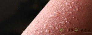 از بین رفتن دائمی موهای زائد