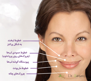 بعد از سه دقیقه پس از تزریق :