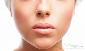 لیزر موهای زائد برای چه افرادی مناسب است؟