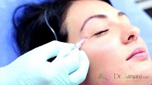 روش انجام کربوکسی تراپی دور چشم