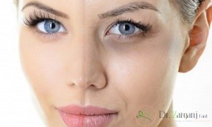 موارد منع استفاده از کربوکسی تراپی در بیماران کدامند: