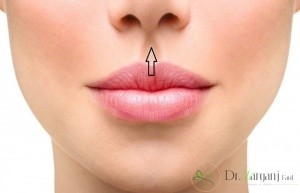 روش مواجه با عوارض لیفت لب با نخ جهت رفع آن کدام است ؟