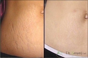 استفاده از درمان با روش کربوکسی تراپی چه نوع احساسی را میتواند در بیمار ایجاد کند: