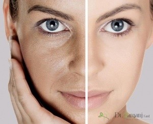 استفاده از گاز دی اکسید کربن برای اولین بار