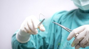 ۱۱- آیا دختران می توانند عمل ترمیم واژن با بخیه انجام دهند؟