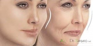 مناطق مفید برای برداشتن چربی