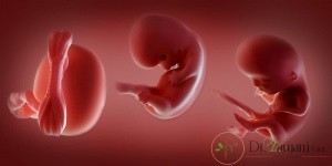 عفونت در زنان باعث نازایی می شود؟