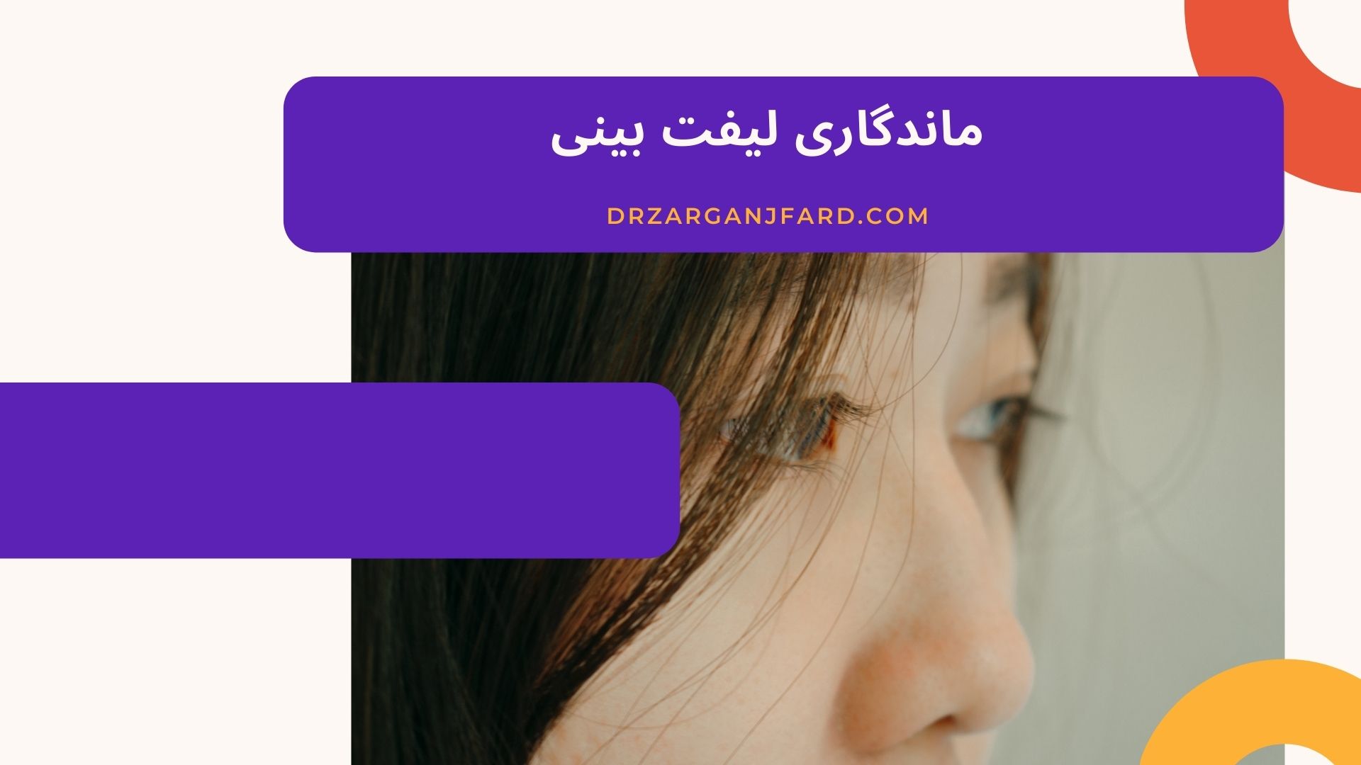ماندگاری لیفت بینی