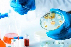بهترین دکتر زنان برای عفونت