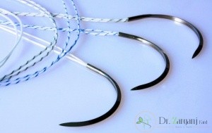 اگر نخ بخیه در بدن بماند چه عوارضی می تواند داشته باشد؟