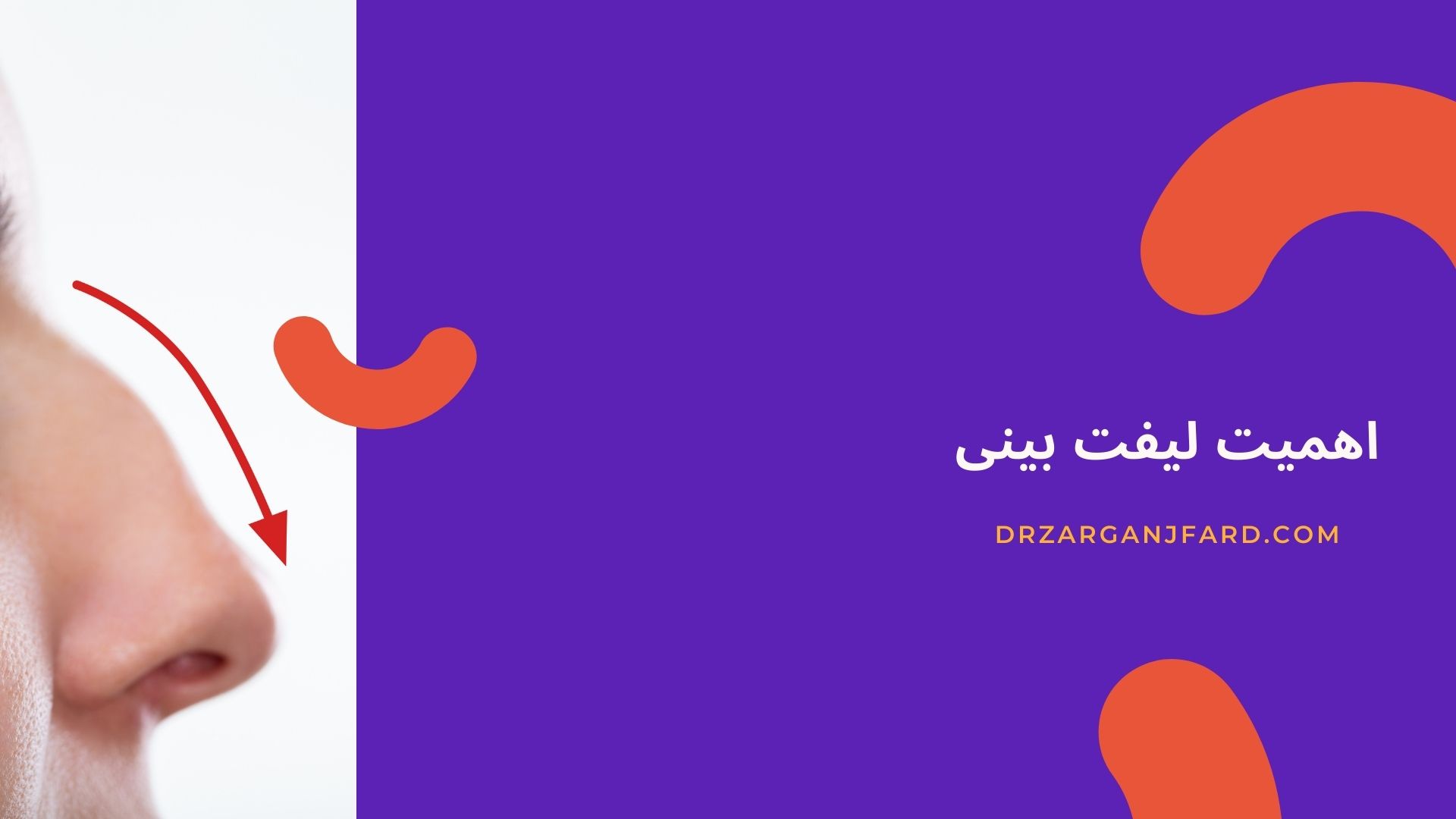 اهمیت لیفت بینی