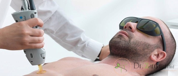 آمادگی های لازم پیش از انجام لیزر شامل چه کارهایی است؟