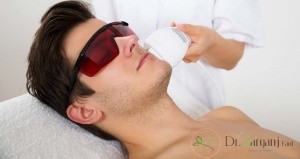 بهترین کاندیدای لیزر