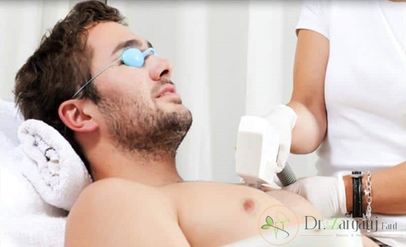 چرا لیزر موهای زائد در بین آقایان مرسوم شده است؟