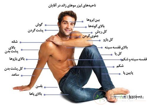 لیزر موهای زائد آقایان چگونه انجام می شود؟