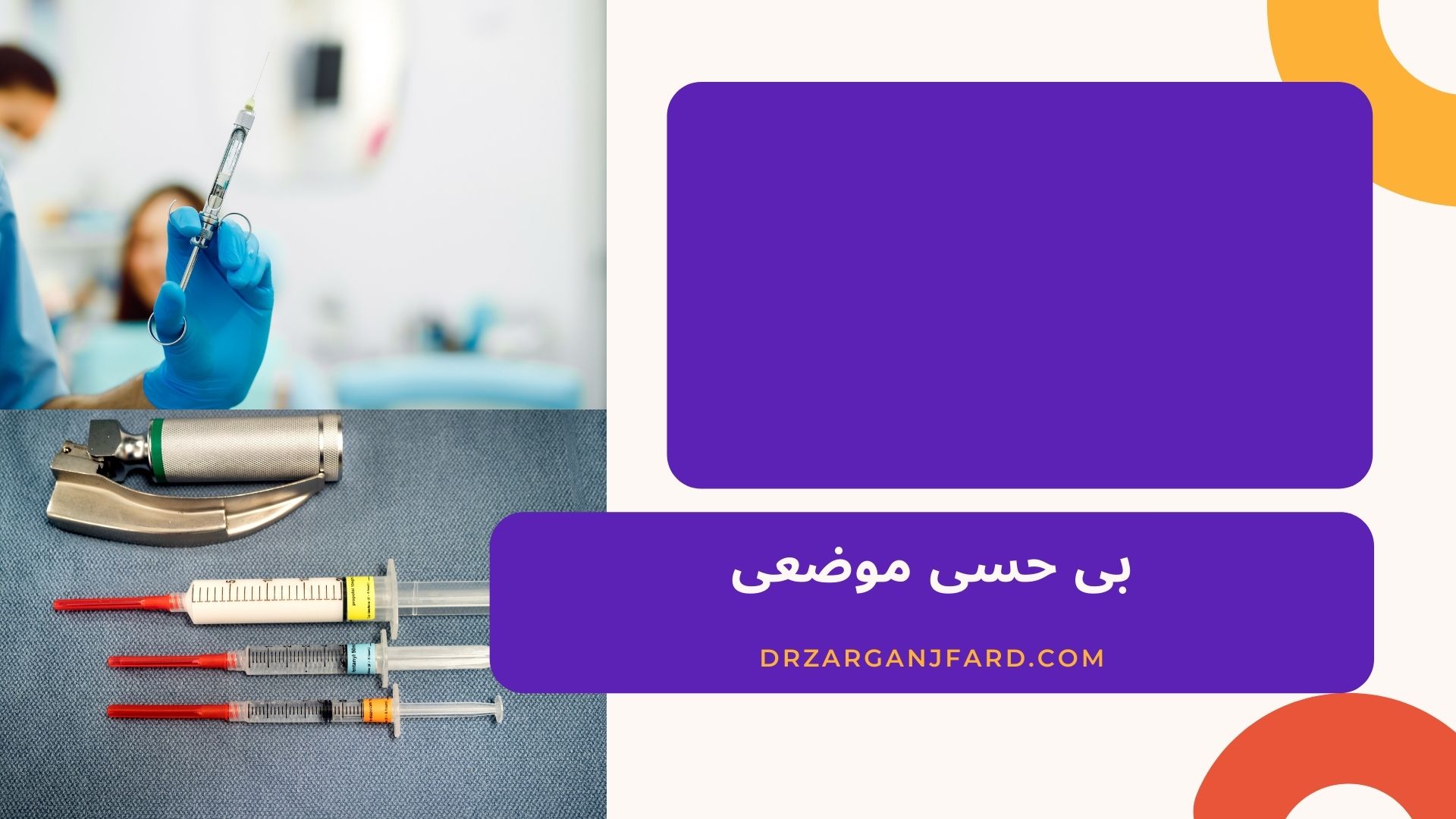 بی حسی موضعی