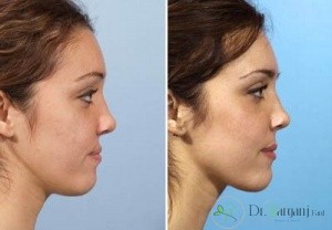 تغییرات میزان تورم در زمان های مختلف