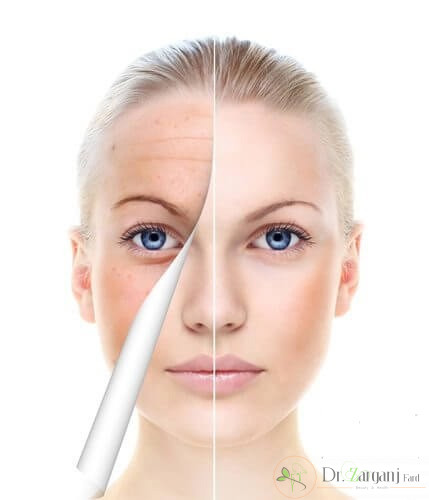 روشن نمودن پوست از طریق لیزر درمانی برای چه کسانی مناسب است؟