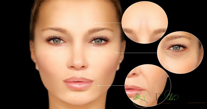 از روش بوتاکس دیسپورت چه انتظاراتی باید داشت؟