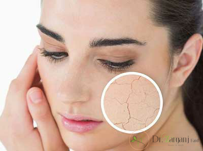 پیری پوست چه نشانه هایی دارد؟