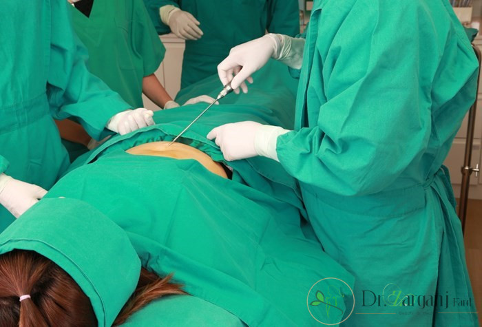 ۲- مزایای تزریق چربی شامل چه مواردی می شود؟