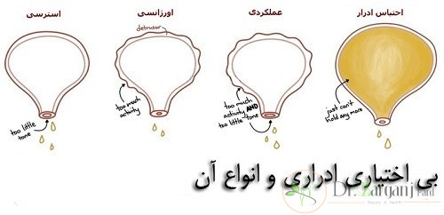 مکانیسم اثر لیزر درمانی در درمان بی اختیاری ادرار چگونه است؟