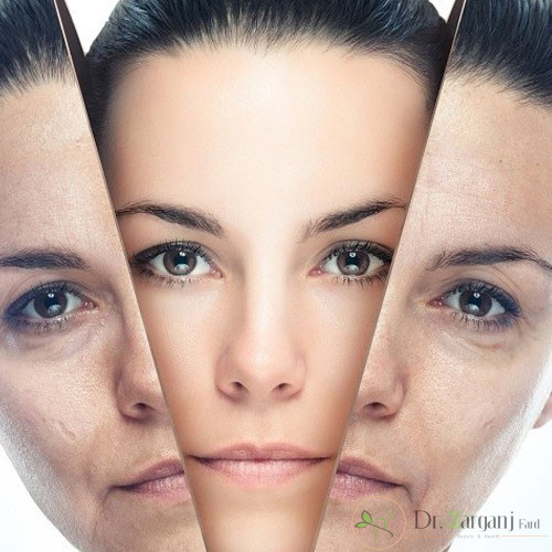 نیاز است از یک تا پنج روز بعد نکات زیر را رعایت کنید: