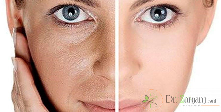 کوکتل های ضد لک و روشن کننده چه خواصی دارند ؟