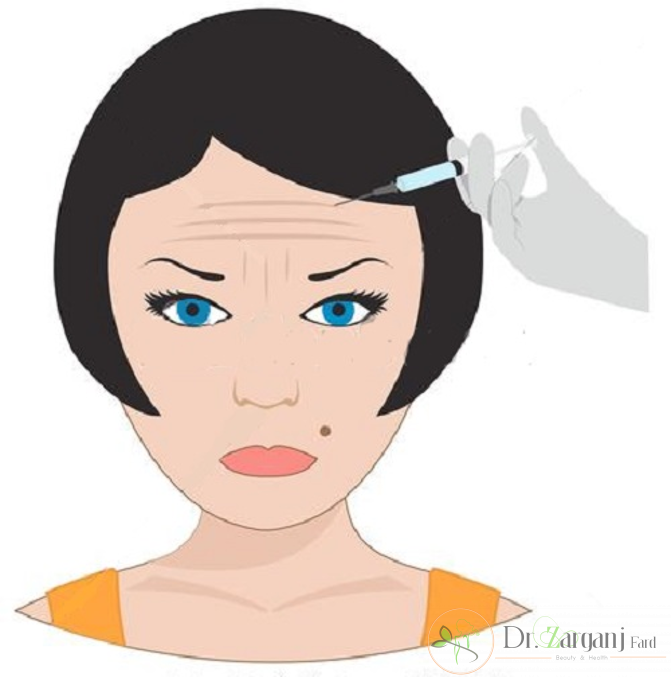 نحوه تزریق بوتاکس برای پیشانی