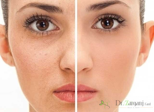 چه دلایلی وجوددارد که پوست دست ها دچار پیری می شوند؟