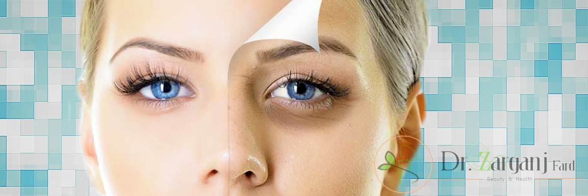 مزونیدلینگ چه مزایایی دارد ؟