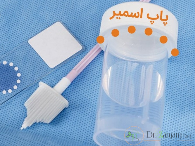 هزینه های انجام آزمایش پاپ اسمیر چقدر است؟