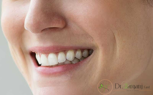با ماندگاری بوتاکس خط خنده آشنایی دارید؟
