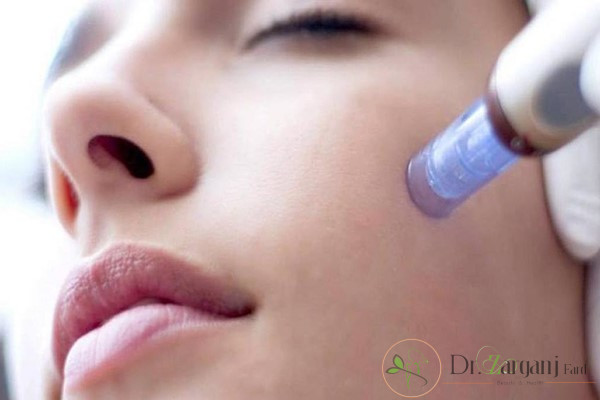 روش کار مزونیدلینگ