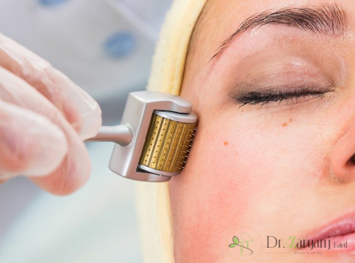 چگونگی عملکرد میکرونیدلینگ