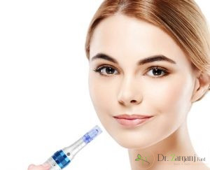 مزونیدلینگ چیست ؟