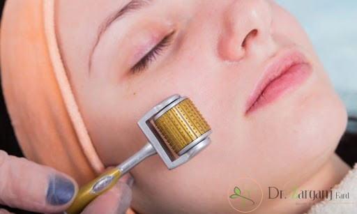 مراقبت های بعد از روش میکروندلینگ و مزونیدلینگ