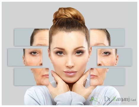 میکرونیدلینگ چیست ؟