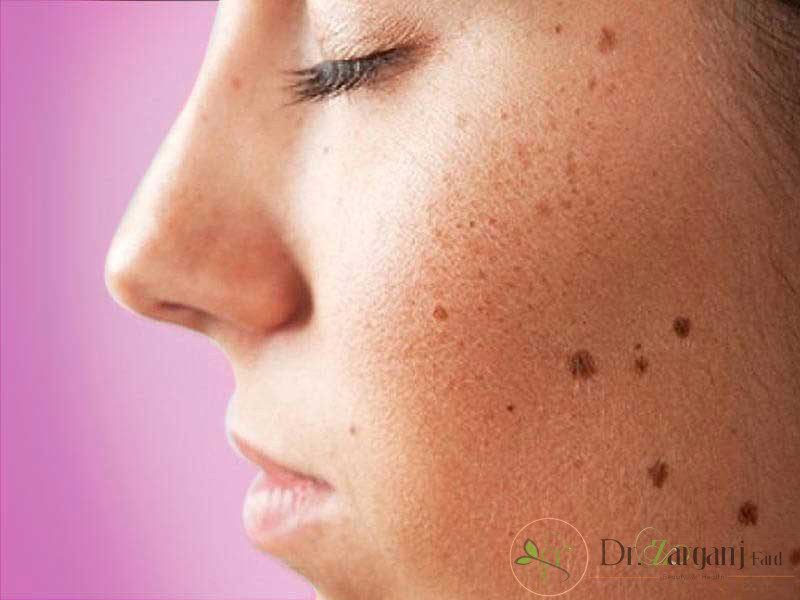 کاربردهای کربوکسی تراپی