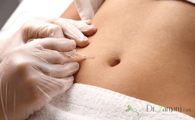 تعداد جلسات لازم برای کربوکسی تراپی شکم