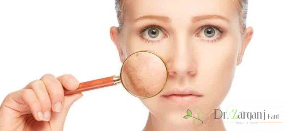 چگونه پوست سالمی داشته باشید ؟