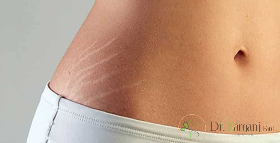 استفاده از کربوکسی تراپی برای چه کسانی ضرر دارد ؟