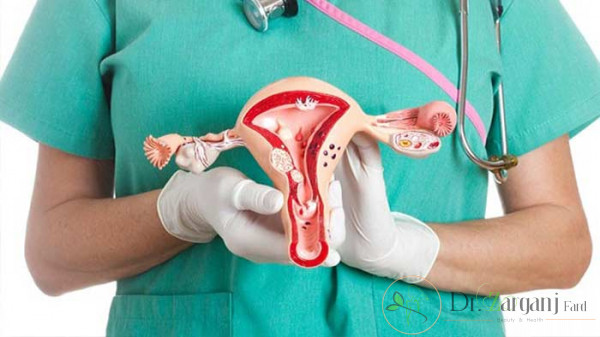 کورتاژ داخل دهانه رحم یا Endocervical Curettage