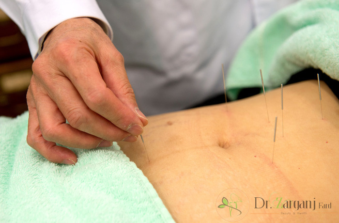 طب سوزنی لاغری و زیبایی: