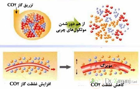 همه چیز در مورد کربوکسی تراپی پلک