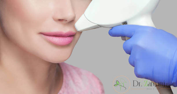 لیزر مو های زائد در کلینیک پوست به چه صورت انجام می شود؟