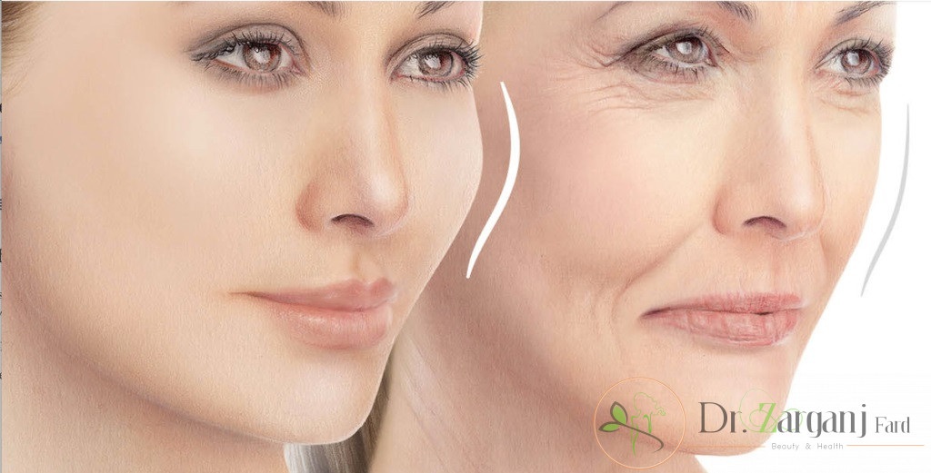 قیمت بوتاکس خط خنده