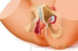 چه عواملی باعث افزایش میزان هزینه تزریق ژل به واژن می شود؟