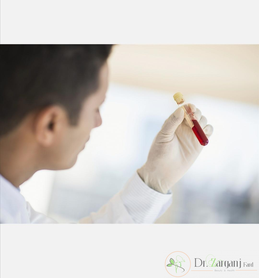 موارد استفاده از prp کدام موارد هستند؟